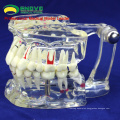 SELL 12567 Life Size Transparent Dental with Implant Tooth